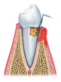 Periodontics